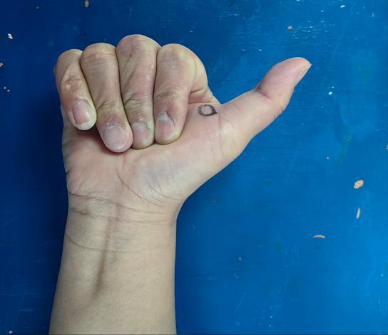 长期刷手机，长沙50岁男子右手变成“扳机指”！专家：这些人是高发群体