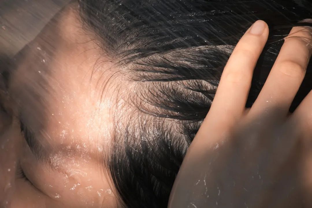 不要用！药物洗头、拖地突然流行，医生：滥用后果很严重