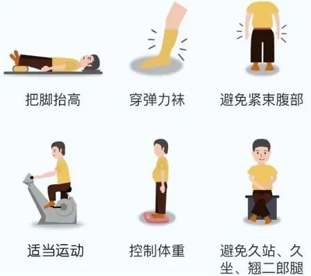 “蚯蚓腿”不好看还难受--静脉曲张的防与治 “蚯蚓腿”不好看还难受--静脉曲张的防与治