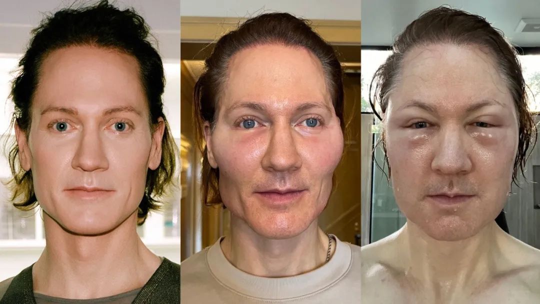 与儿子换血，这位富豪每年花200万美元抗衰