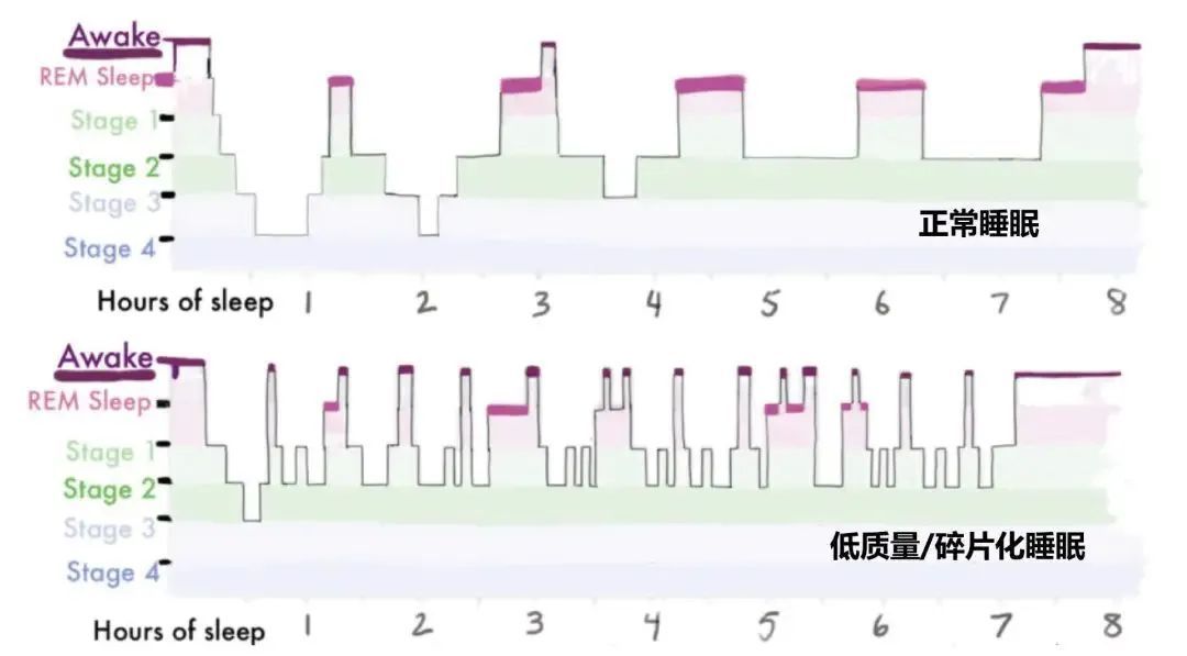 睡够八小时还是巨累！多半因为这个原因