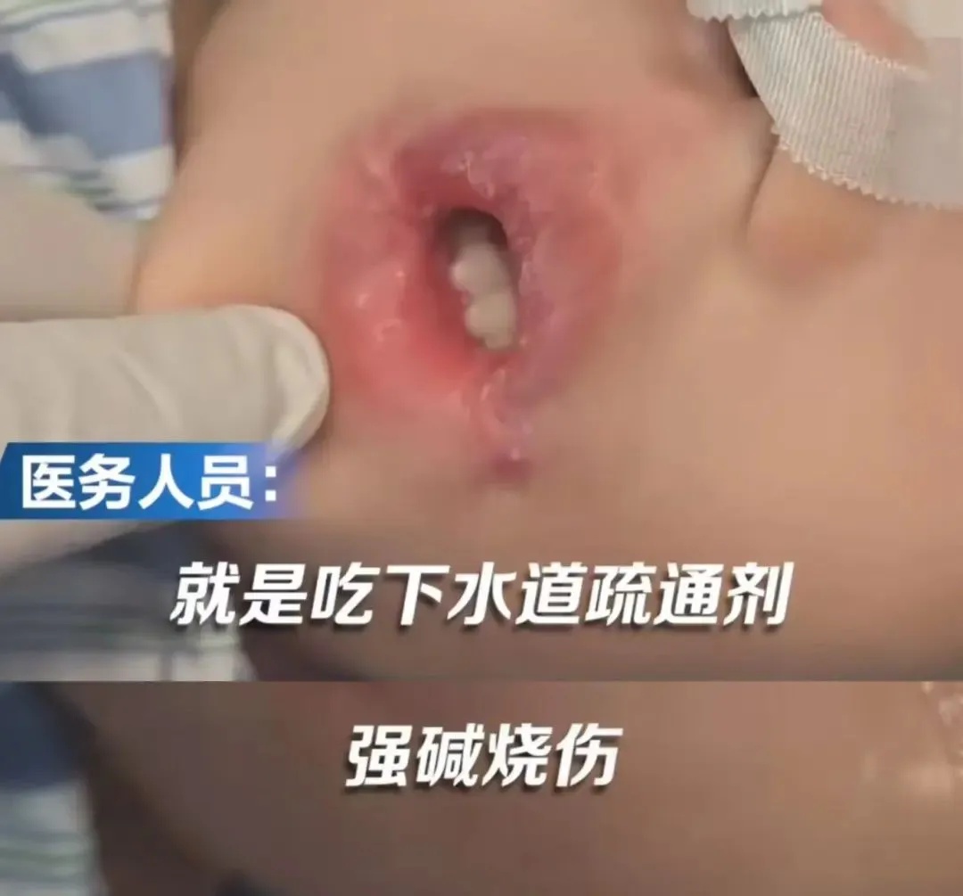 不是危言耸听!才几秒钟,男孩双手差点不保!这东西家家都有 不是危言耸听!才几秒钟,男孩双手差点不保!这东西家家都有