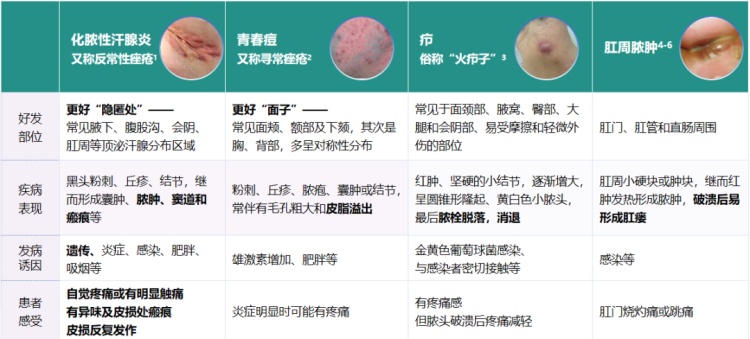 女子受难言之苦煎熬10年，极易被误诊！这三种情况及时就医