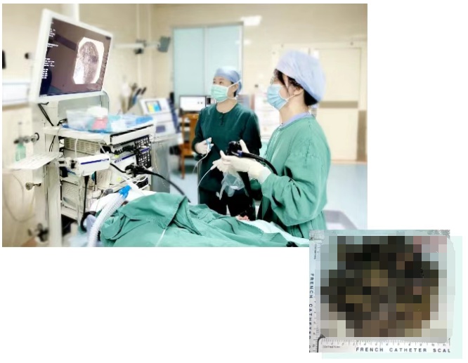 15岁女孩确诊，根本控制不住！从胃里取出整整4斤……