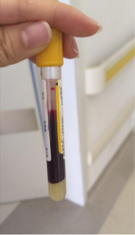 警惕！深圳一男子抽出“牛奶血”