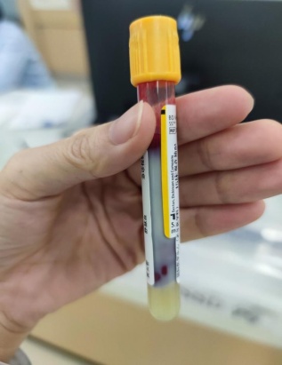 警惕！深圳一男子抽出“牛奶血”