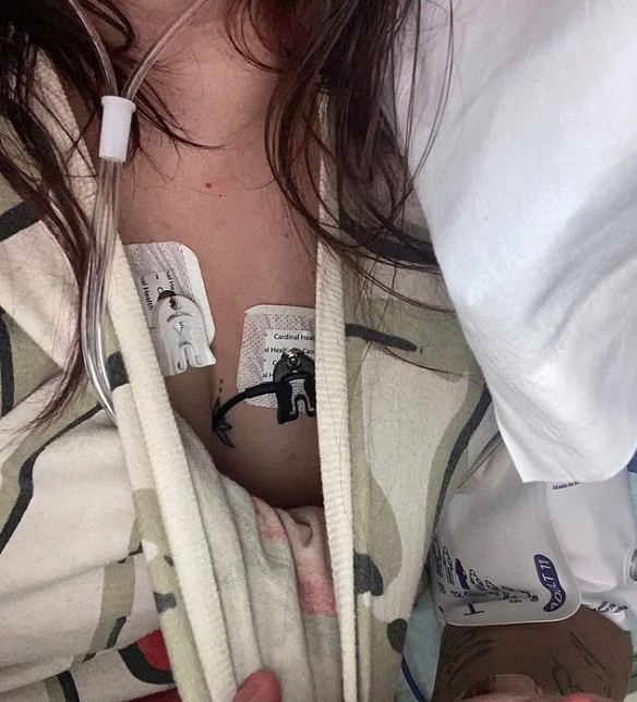 美国年轻妈妈每天吸300口电子烟，检查发现肺部有电子烟油