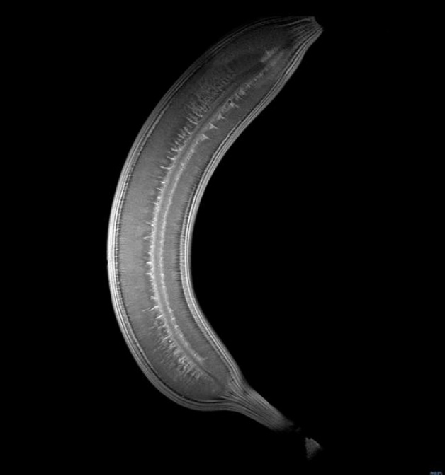 避免事故，了解原理，避开误区——去医院做核磁共振先看这份科普指南