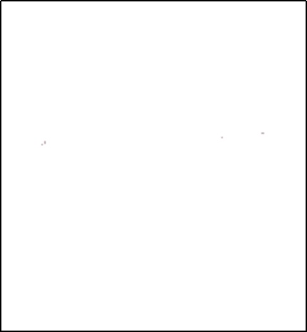 避免事故，了解原理，避开误区——去医院做核磁共振先看这份科普指南