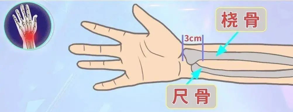 22岁小伙摔倒以为没事，7天后死亡！紧急提醒