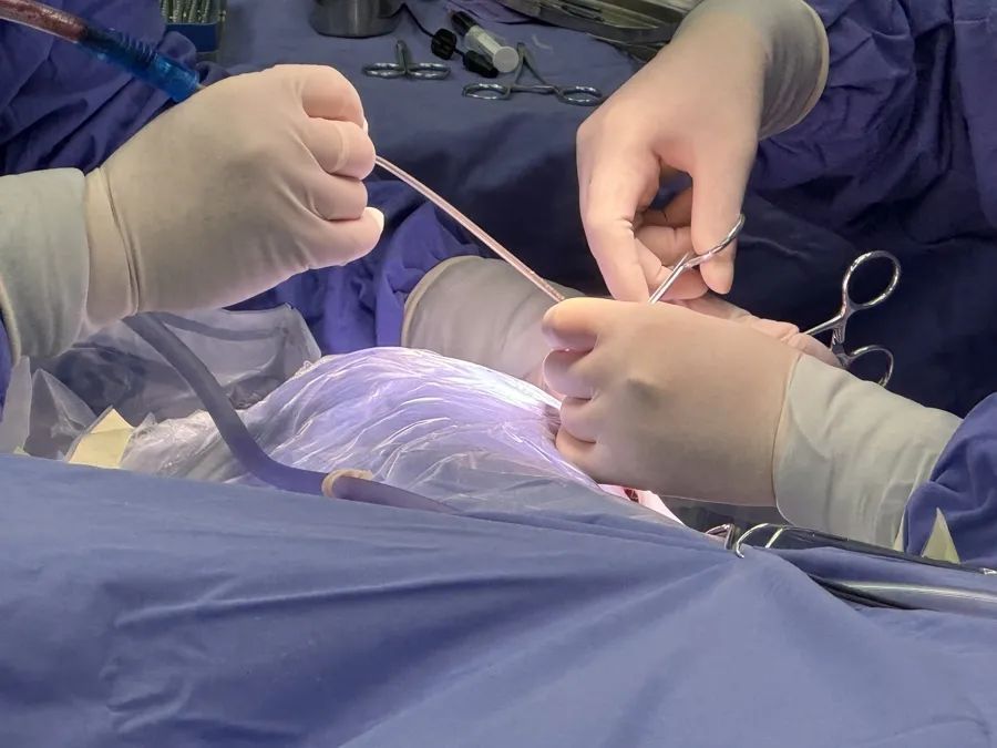 耳朵前的这个“聪明孔”，是鱼鳃演化残迹？其实是发育畸形，还会遗传！