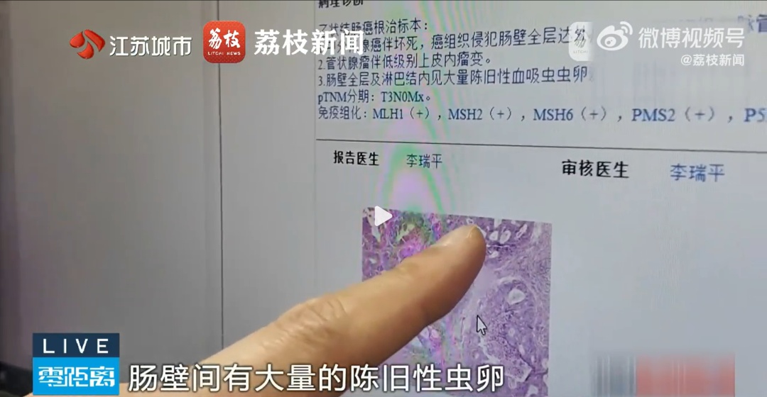 接触10秒即可感染！一旦出现这些症状，立即就医→