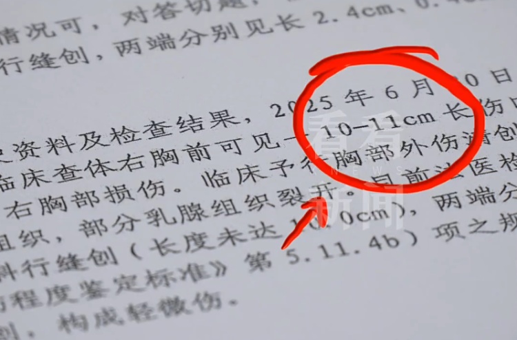 噩梦！上海一女子屡遭家暴！被打断肋骨、划伤胸部……