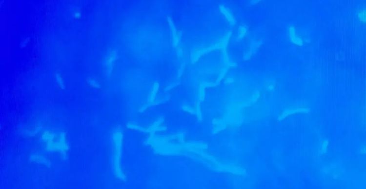 一到夏天，好多人后背爬满“花斑”？其实是被感染了