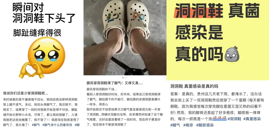 一到夏天就长脚上，这种鞋怎样穿更安全？