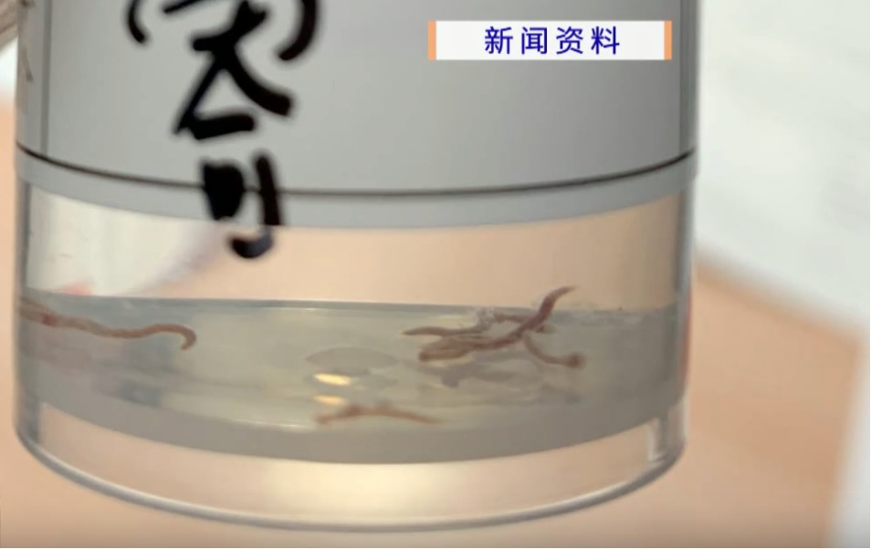 广东阿婆面色蜡黄重度贫血，胃镜查出十几条活虫！医生：和这一习惯有关