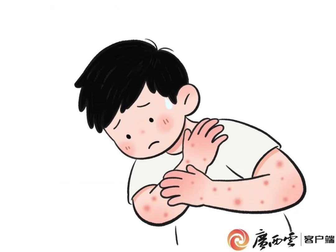 蚊子送来“痛痛礼包”？千万别要！医生专家教你拒收技巧