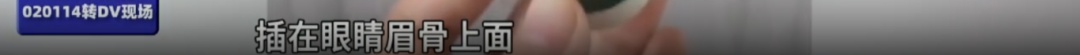 真没想到“杀伤力”如此惊人！击穿眉骨、扎穿手指...已有多人受伤！近期人气飙升