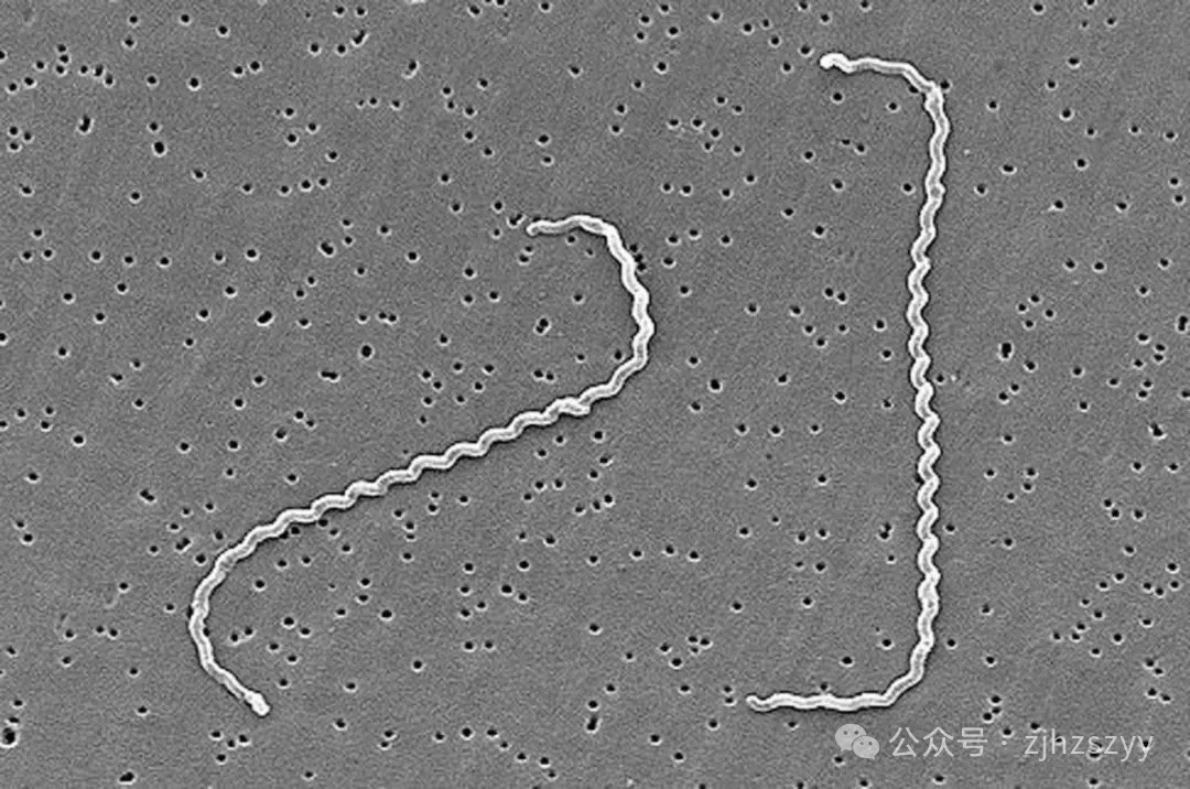 10秒感染，48小时极危险！浙江男子去了趟山里高烧42℃险丧命！夏天特别容易中招