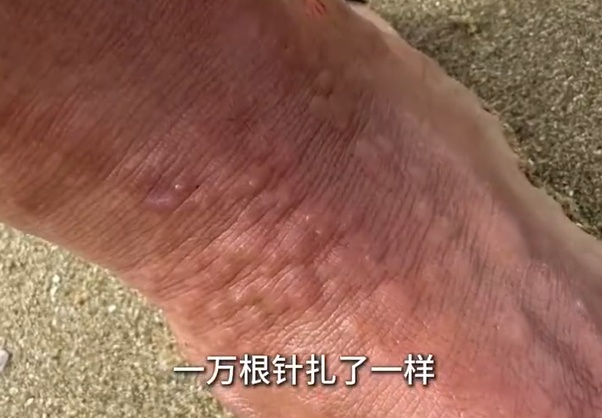 为追跳跳鱼，一男子被“封印”在海滩上 赶海时，这些事项要注意