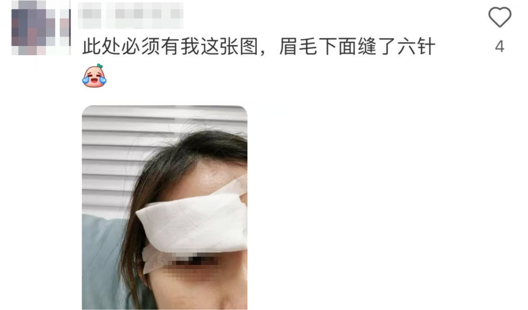 真没想到“杀伤力”如此惊人！击穿眉骨、扎穿手指...已有多人受伤！近期人气飙升