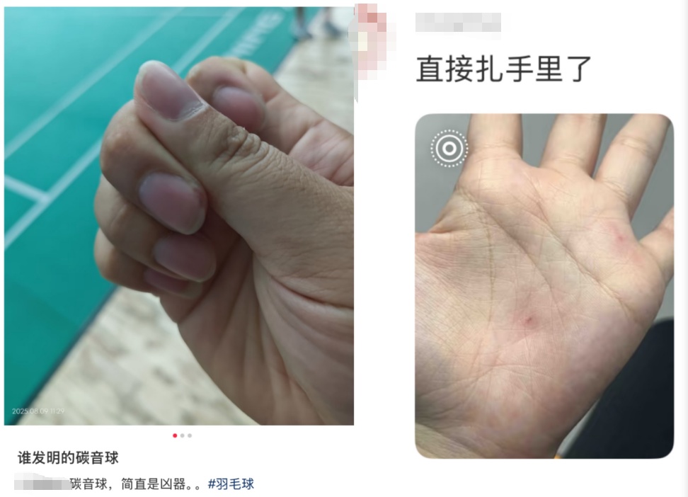 真没想到“杀伤力”如此惊人！击穿眉骨、扎穿手指...已有多人受伤！近期人气飙升