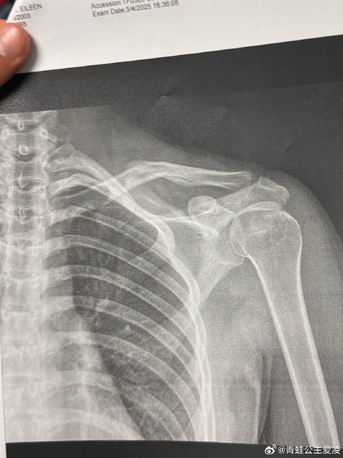 谷爱凌，“因人为事故遭可怕意外”！请不要再做这件事→