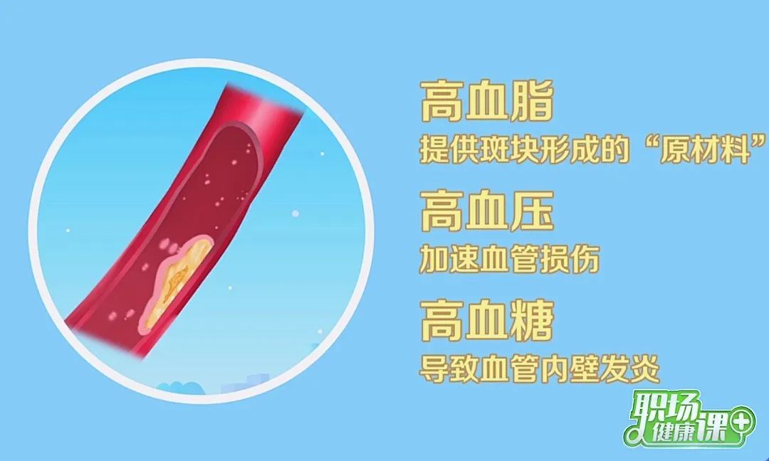 软斑块vs硬斑块,哪个更危险?做好3件事,血管年轻10岁! 软斑块vs硬斑块,哪个更危险?做好3件事,血管年轻10岁!