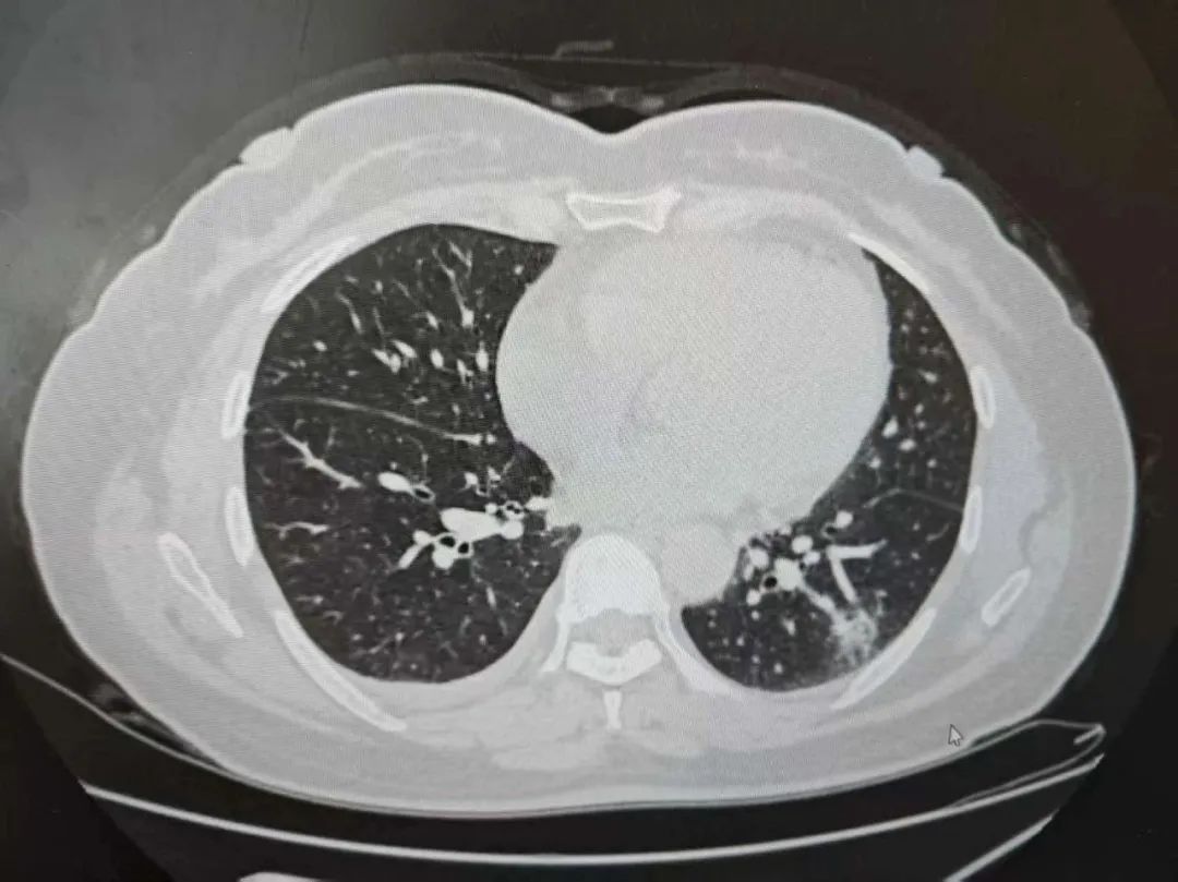 歌手王嘉尔食物中毒，紧急送医！杭州也有人中招…