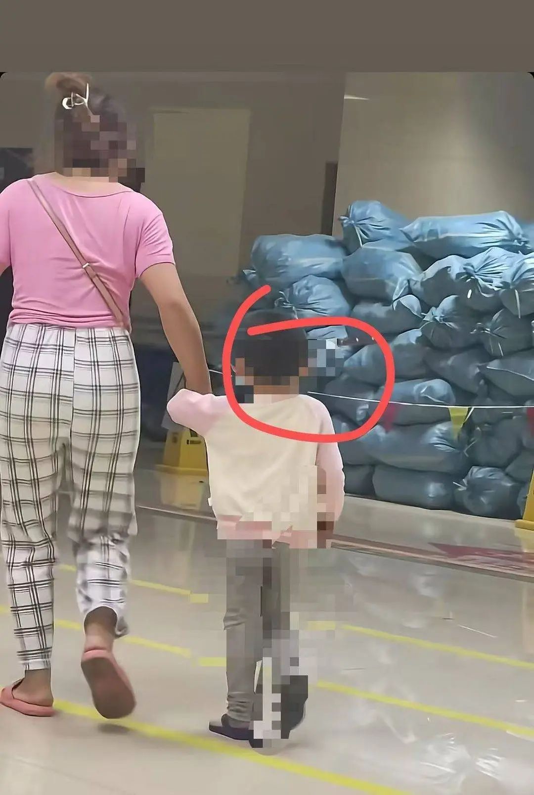 揪心！3岁女童"头上插刀"，淡定走进医院