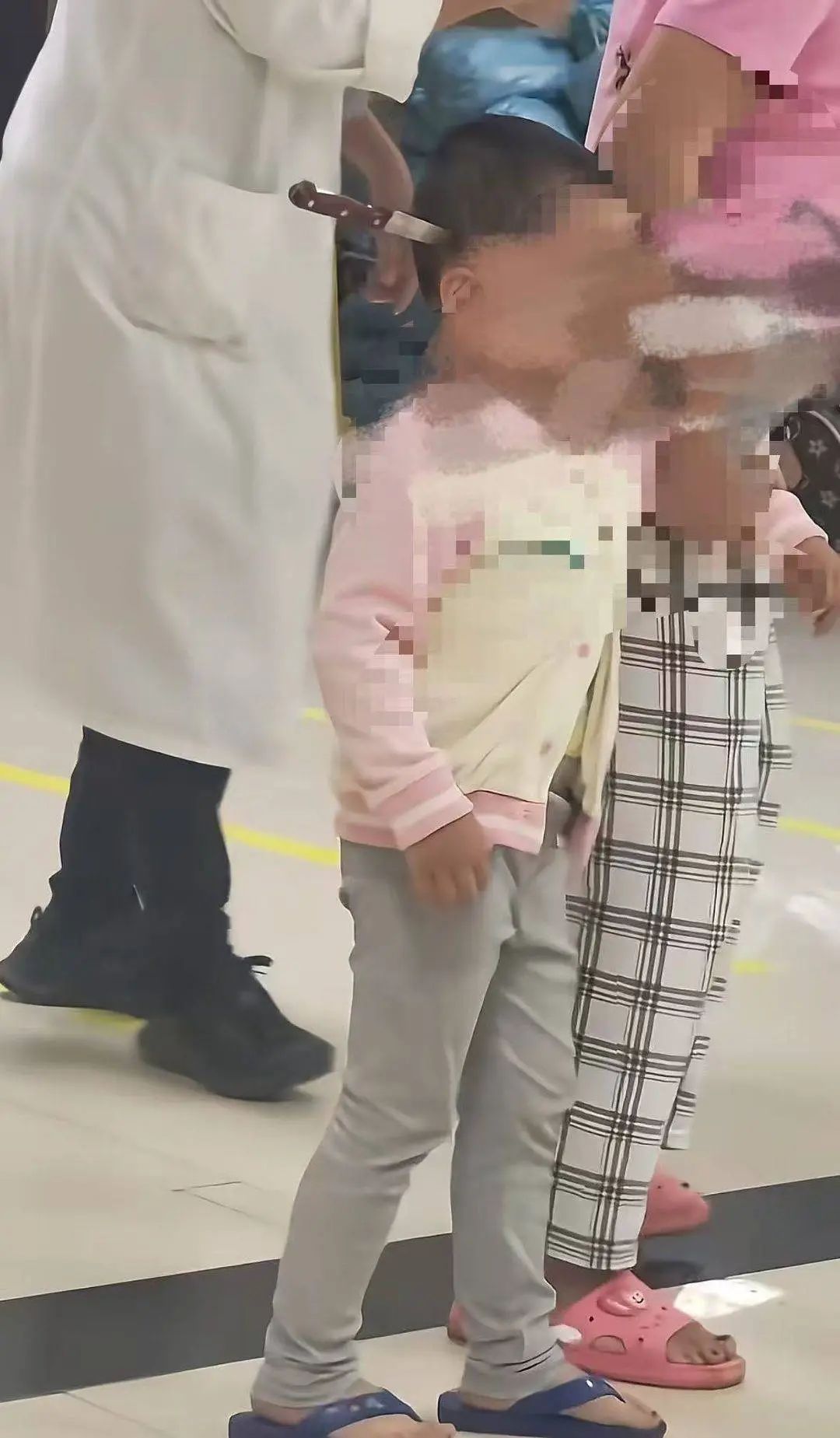 揪心！3岁女童"头上插刀"，淡定走进医院