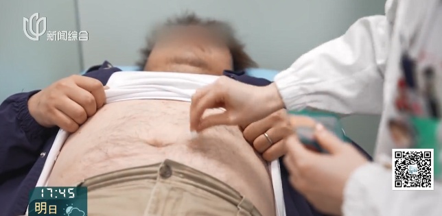 需求突然暴增！上海三甲医院数据惊人：50人减掉739斤！大量年轻人涌入