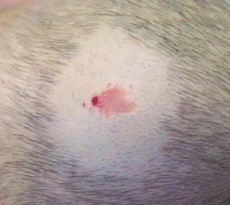 头上的痣暗藏癌变风险？出现这3种情况一定要警惕