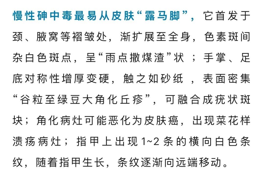 越来越黑！一女子脖子总洗不干净，竟是中了“砒霜”之毒！医生提醒→