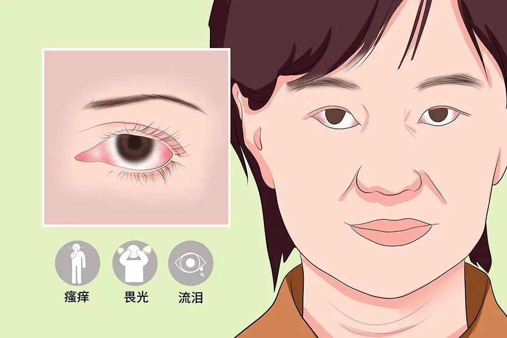 夏日“毒王”！男子中招又传染给孕妻和儿子！紧急提醒：进入高发期