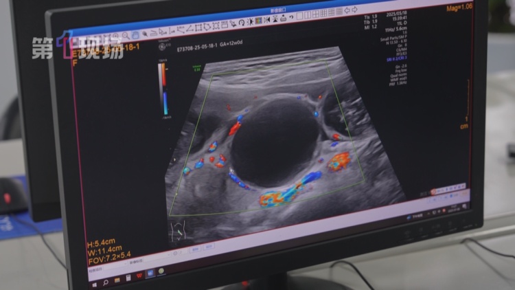 会要命，赶紧扔！有人差点肠穿孔，很多人常买......