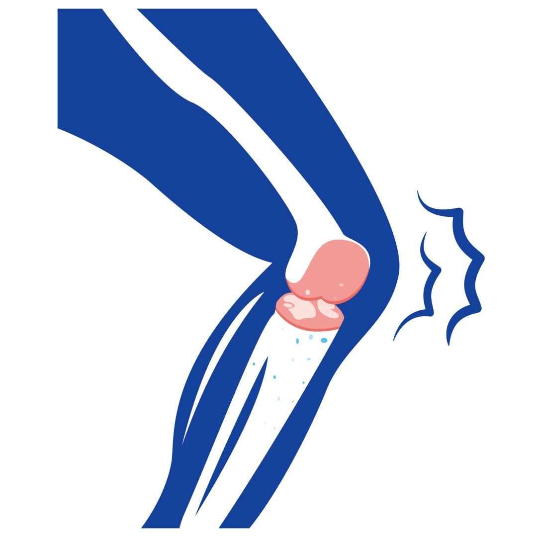 这几个加速膝盖报废的动作，你可能天天做！