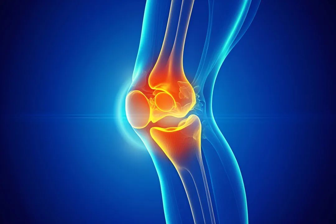 这几个加速膝盖报废的动作，你可能天天做！