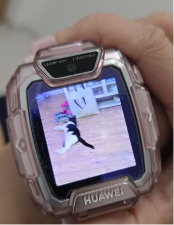 杭州5岁女孩背上惊现“梅花印”，罪魁祸首竟是家里的……