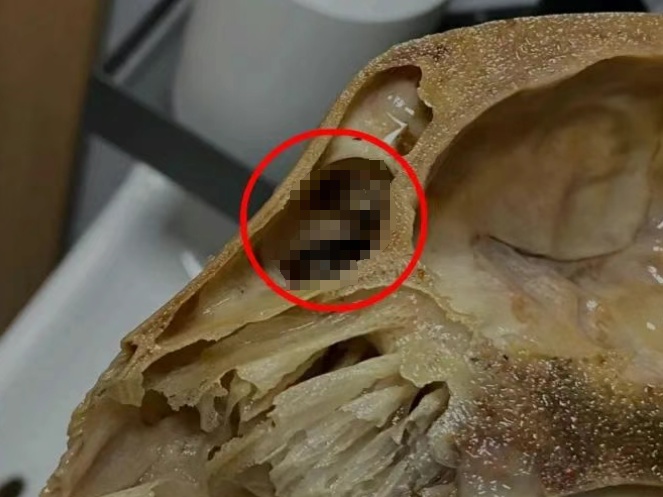 吃完发现全是蛆，恶心呕吐一整夜！判了：赔1000元