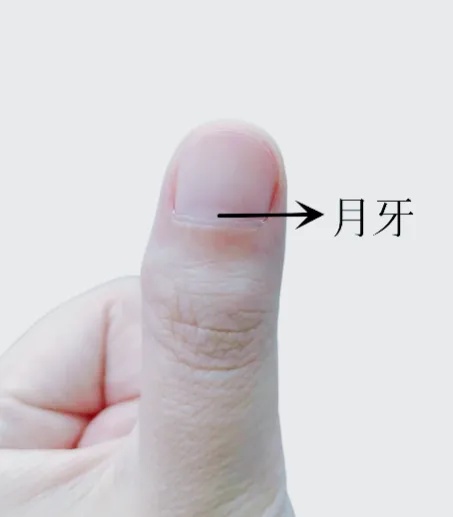 紧急提醒：指甲出现这个变化，可能是癌变！别不当回事！