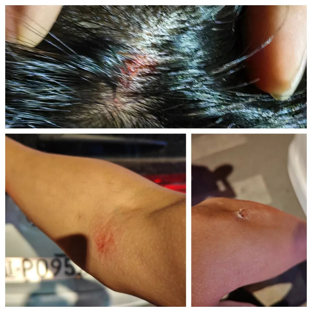 危急时刻，警车一横，救了5条命！