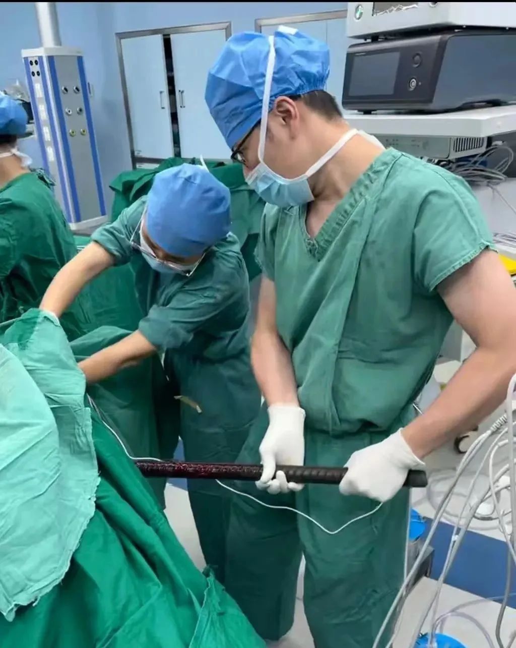 佛山一男子意外从高空坠落，1.5米长钢筋从肛门贯穿胸腔......