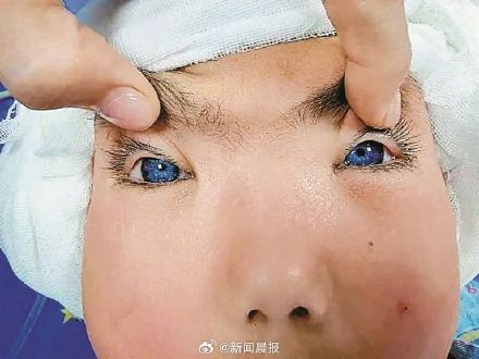 深圳一对夫妻生出蓝眼睛白头发宝宝，医生这样说……