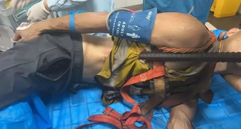 佛山一男子意外从高空坠落，1.5米长钢筋从肛门贯穿胸腔......