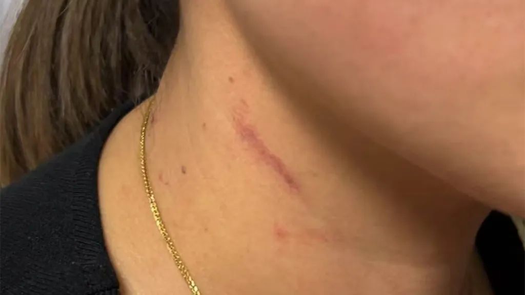 云南一男子怀疑妻子出轨，凌晨逼问并施暴，被行拘！当事女子：已下定决心离婚