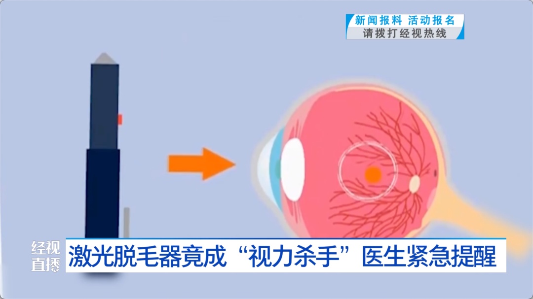 使用时操作不当，女子眼睛“黄斑区灼烧成了一个洞”！很多人夏天爱用，医生紧急提醒
