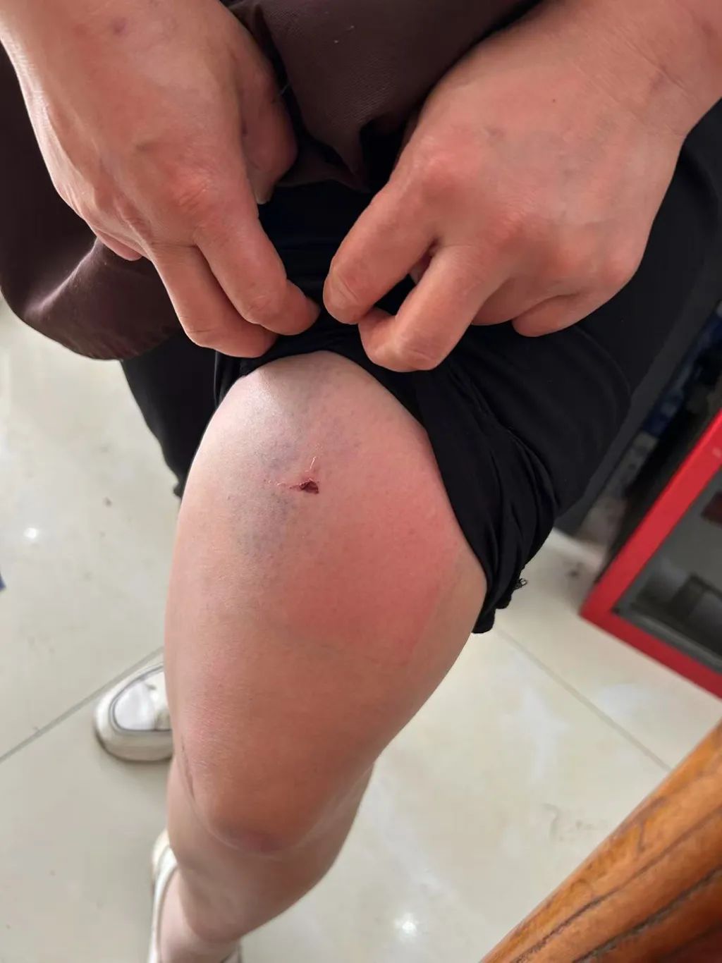 云南一男子怀疑妻子出轨，凌晨逼问并施暴，被行拘！当事女子：已下定决心离婚