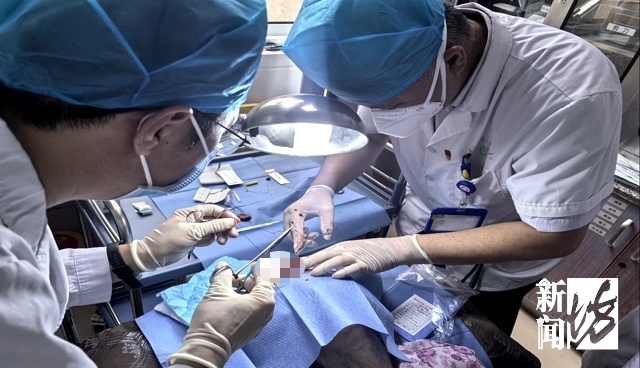 太狠了！上海一老人拿起剪刀，居然把自己身上的…剪掉了！医生也傻眼了…