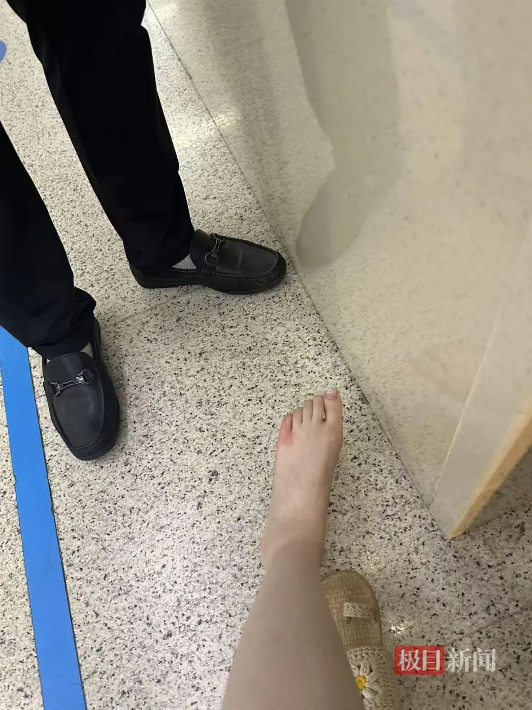 女子在苏州一五星级酒店疑被蜈蚣咬伤，酒店：正积极处理